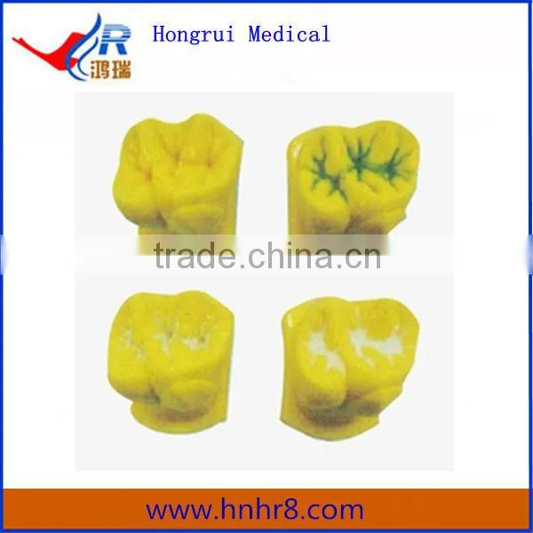 High Quality Fissure Sealant Demonstration Teeth Model