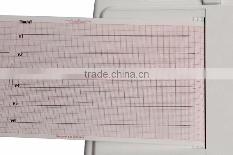 OEM Six channel digital ECG machine 12-lead Digital 6-channel Electrocardiograph
