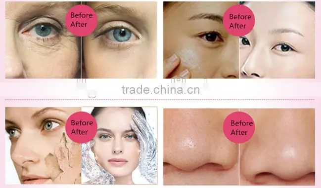 Nano Ionic Facial Steamer home use electric facial steamer portable facial steamer