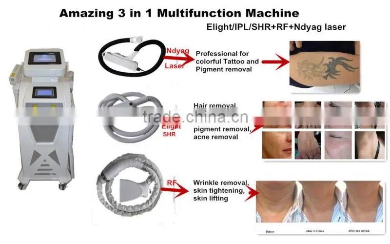 Ipl elight laser 5 in 1 hair removal beauty equipment