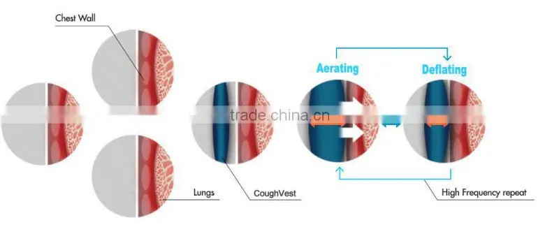 High Frequency Chest Wall Oscillation(HFCWO) for Aiway Clearance