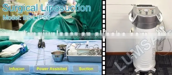 Liposuction Surgery Use Liposuction for Plastic Surgeon