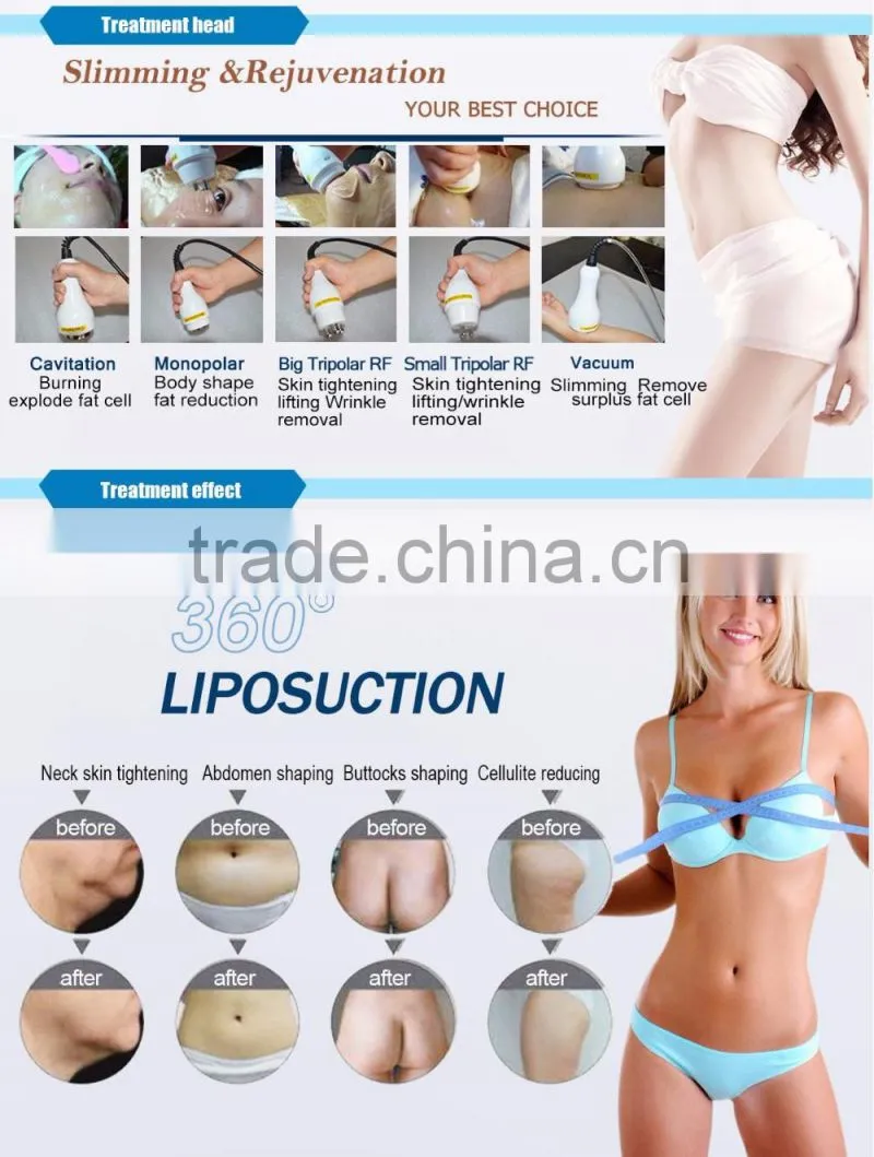 2017 multifunctional 8 in 1 Elight SHR yag q switch laser for hair removal tattoo removal slimming
