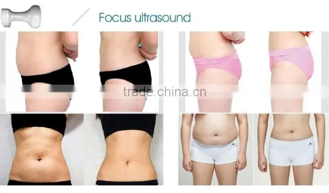 sanhe hifu body shaping fat removal slimming machine/Hifu slimming