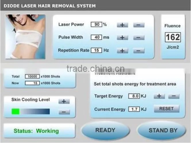 portable diode laser hair removal machine