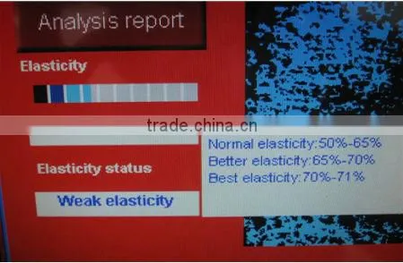 Auto-digital top CBS skin and hair analyzer