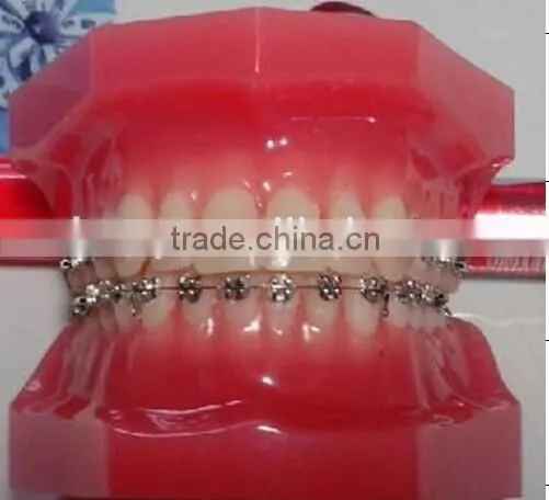 dental manufacturer Hot-sell ceramic red teeth orthodontic model