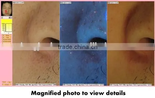 3D face camera equipment / professional skin analyzer for beauty salon
