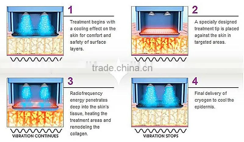 Best thermagic lift fractional rf facial lift beauty equipement