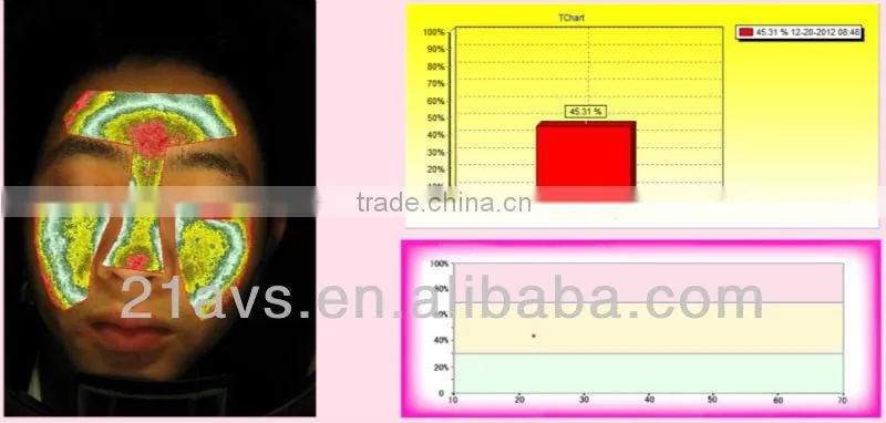Guangzhou facial skin analysis machine