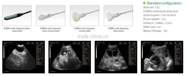 cheap China portable color doppler ultrasound ce approved veterinary use full digital ultrasound scanner