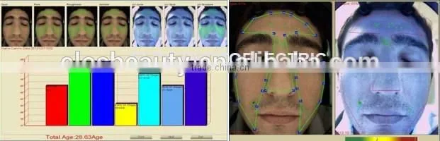 Professional Facial Skin Scanner Analyzer