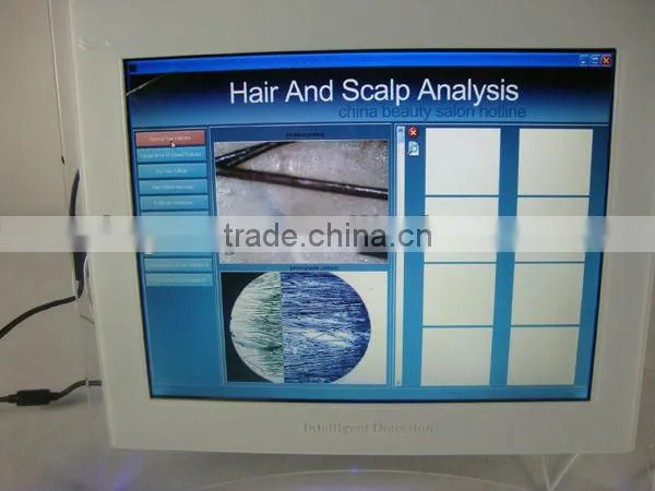 hair analysis software/skin and hair analysis