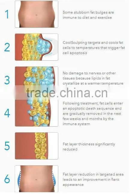 2015 Cryolipolysis Lipo Laser Anti Cellulite Multifunction machine