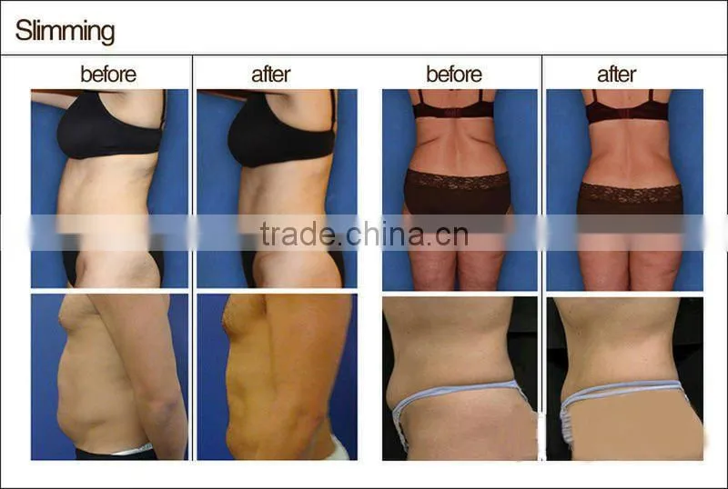 2014 portable ultrasound cavitation beauty machine for fat reducing