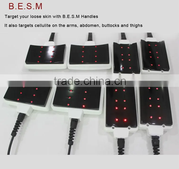 HEMS Weight loss body rejuvenation system cryo cold