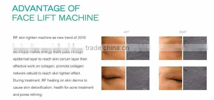 Home use mini beauty instruments rf skin tighten machine
