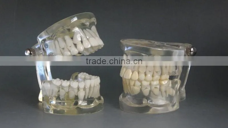 Teaching Using Transparent Deciduous Teeth Development Model 1