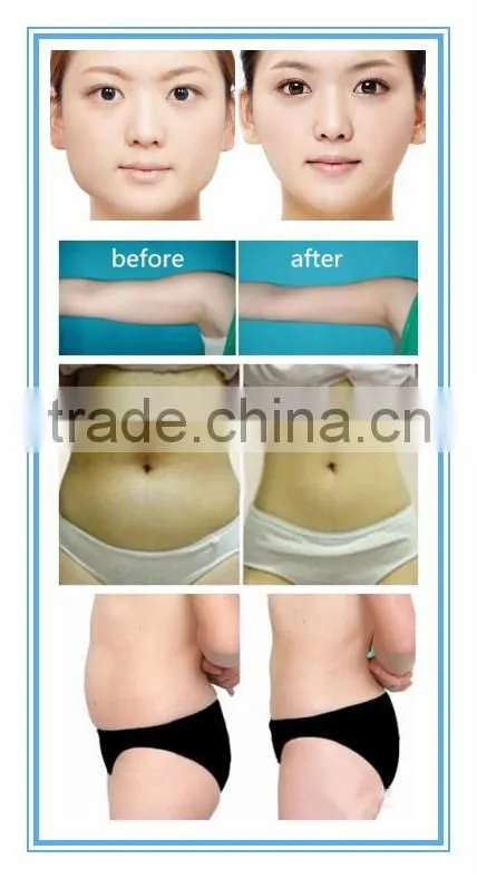 Professional Vacuum Radio Frequency Slimming Machine