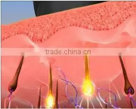 Most selling products ipl shr pain free fast hair removal machine spa equipment HS 650 by shanghai med apolo medical technology