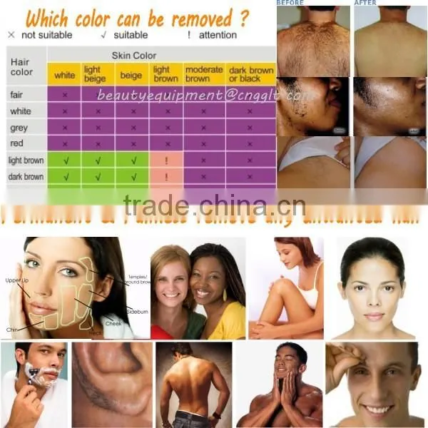 Promotion mini 808 laser hair removal machine price