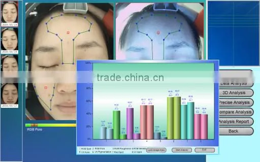 2016 popular portable magic mirror skin analyzer skin analysis machine