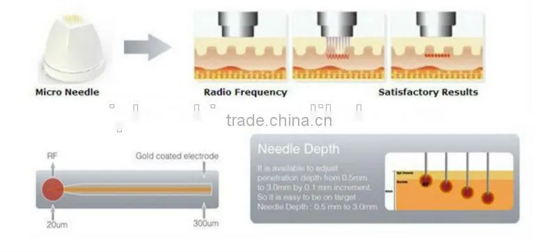 Advanced high quality professional fractional radio frequency