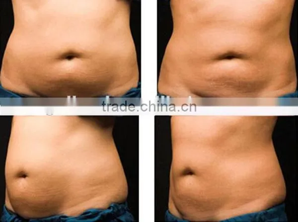 Multipolar RF 6 in 1 cavitation laser slimming machine/fast cavitation slimming system