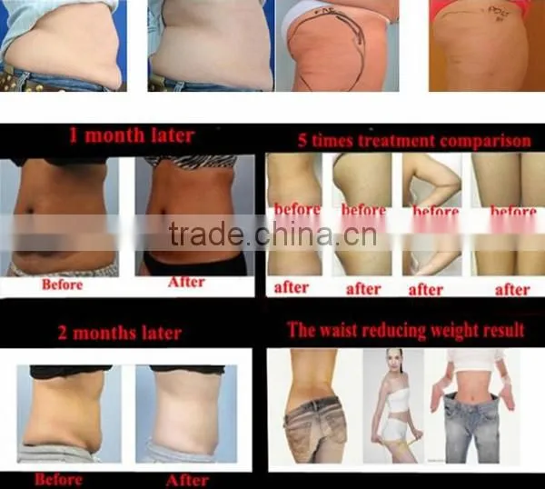 ultrasound cavitation slimming gel for sale
