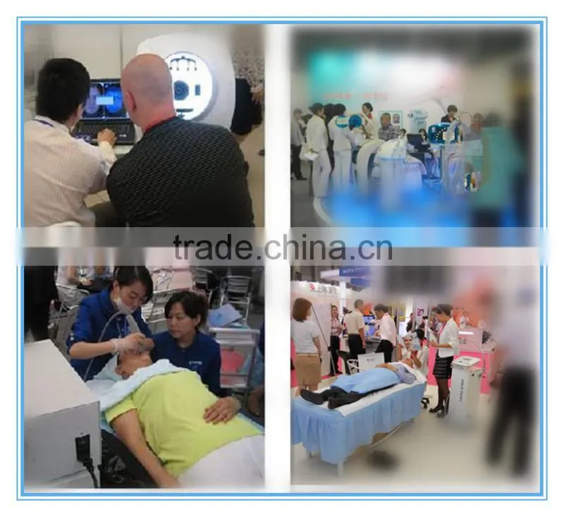 Aroma epilator laser hair removal machine diode