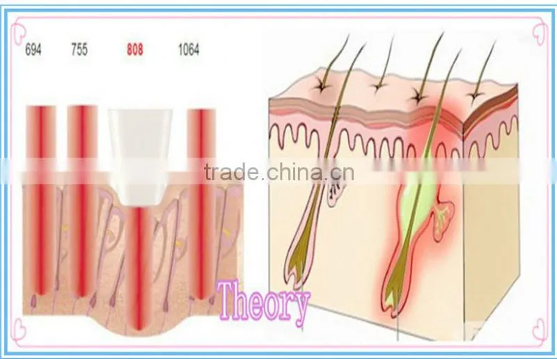 home laser hair removal device experimented maine