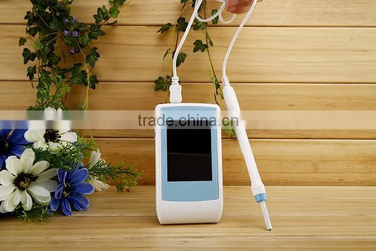 China Low price1.3MP Best Dental Cameras With Monitor for 2016