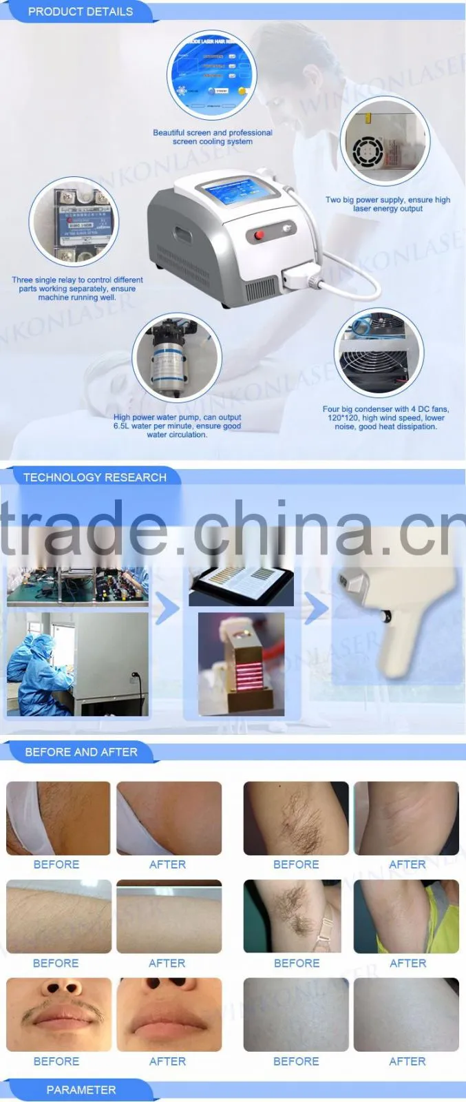 2016 painless wax hair removal ! 808nm diode laser hair removal machine for salon use