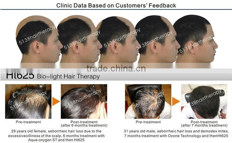 multifunction therapy hair loss treatment pdt beauty equipment