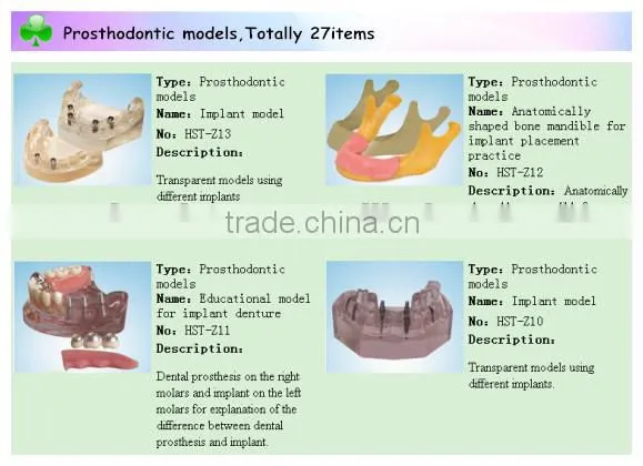 Root Canal Filling Model dental model