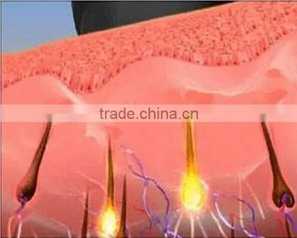 2015 Hot IPL Elight SHR Three in One Permanent Hair Removal Machine With CE Approved for Skin Rejuvenation and Hair Removal