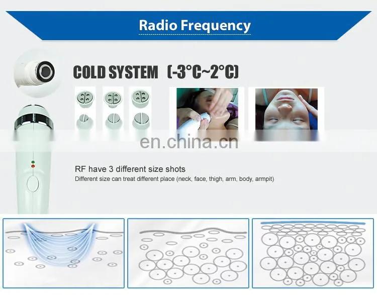 OPT ND YAG LASER RF Beauty Machine Elight Multi-functional Tattoo Removal Hair Removal