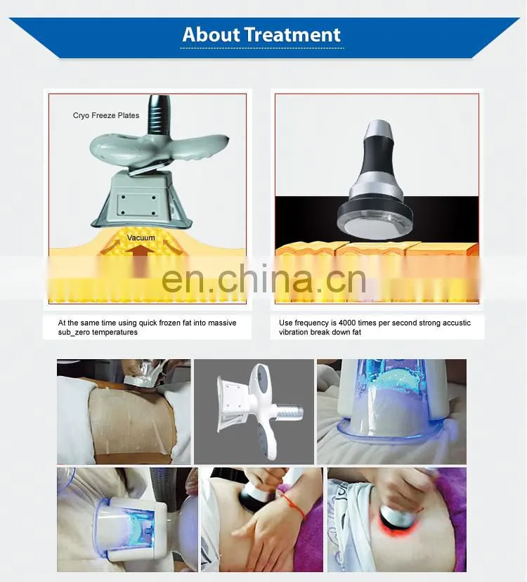 2022 new Item two cryo handles work at the same time 360 Cryo Slimming Machine double chin removal