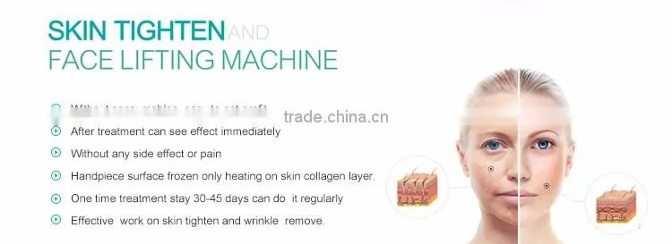 Home use mini beauty instruments rf skin tighten machine