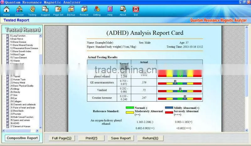 China Supplier 14 inches Display Quantum Magnetic Body Analyzer