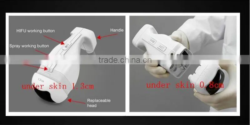 AYJ-S10(CE) liposonic slimming machine / liposunic device for reduce fat