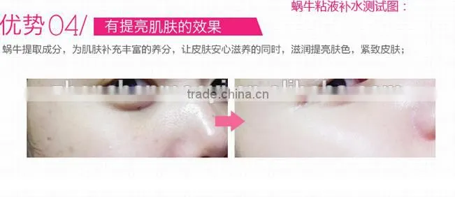 The 2015 best quality NR Whitening Snail Extract Cream