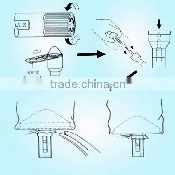 Disposable Alimentary Tract Stapler / Circular Stapler