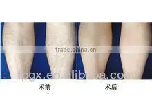 Portable mini ipl machine