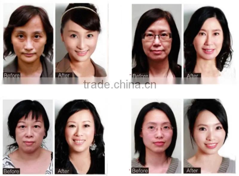 2014 As Seen As TV Face Liftiong Beauty Equipment Radio Frequency Machine Home