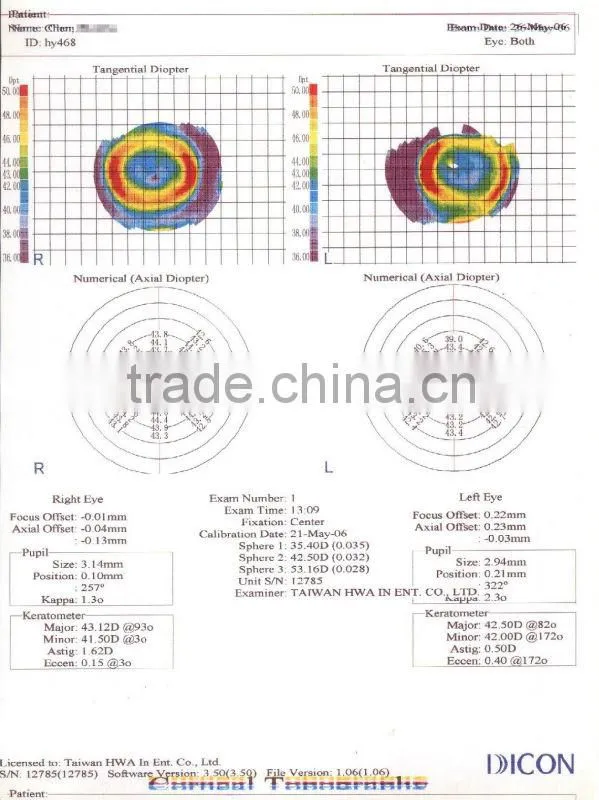 Digital Rigid contact lens for Presbyopia control / MCT/ Luxuriant metamorphosis of RGP Lenses