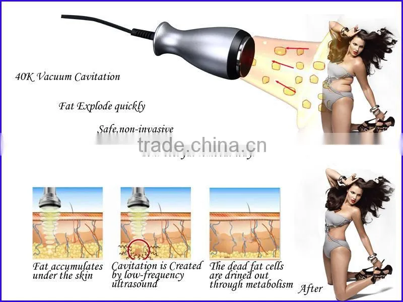 cavitation+auto-roller vacuum+tripolar rf+cryotherapy 5 in 1 vacuum cavitation device,vacuum device