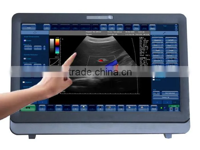 Touch Screen Color Doppler Ultrasound Scanner C8 model