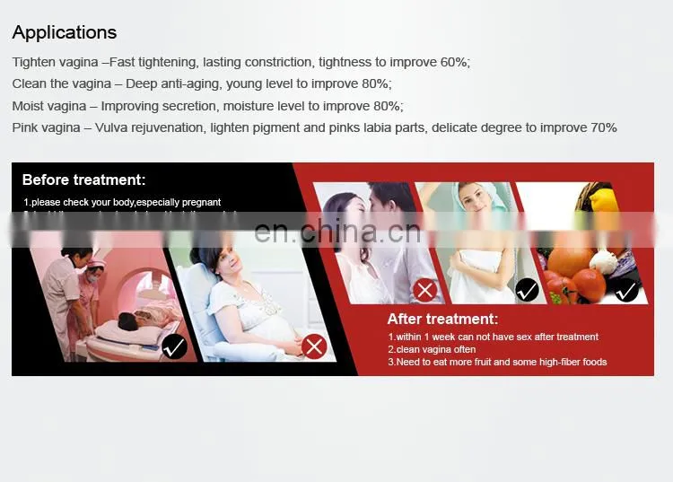 Good Feedback Fractional CO2 Laser Portable Medical Surgical Stretch Mark Removal Machine