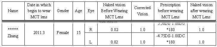 MCT Hard lens For low myopia/MCT lenses/no operation treat myopia,make your eyes normal